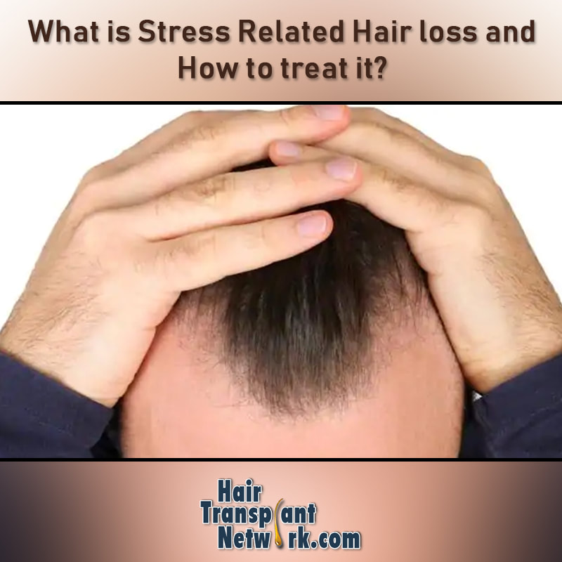 What Is Stress Related Hair Loss And How To Treat It?